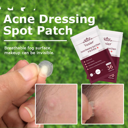 Acne Spot Skin Care Stickers Patch